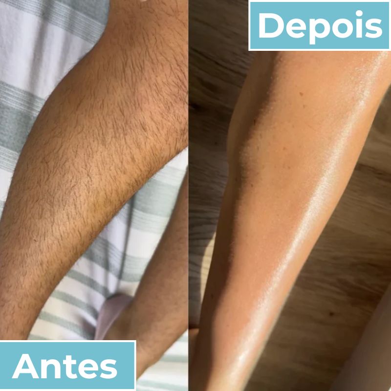 LisoPro™ - Obter uma pele suave em segundos